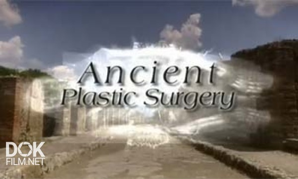 Пластическая Хирургия В Древности / Ancient Plastic Surgery (2004)