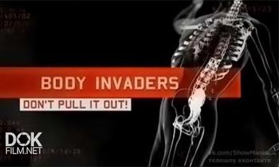Инородные Тела: Не Вытаскивайте! / Body Invaders. Don\'T Pull It Out! (2013)