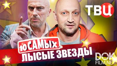 10 самых... Лысые звезды (2025)