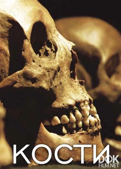 Кости/ Bones (2018)