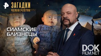 Загадки человечества с Олегом Шишкиным. Сиамские близнецы (08.10.2025)