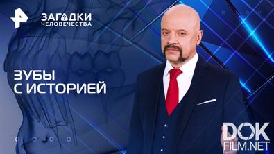 Загадки человечества с Олегом Шишкиным. Зубы с историей (28.04.2025)