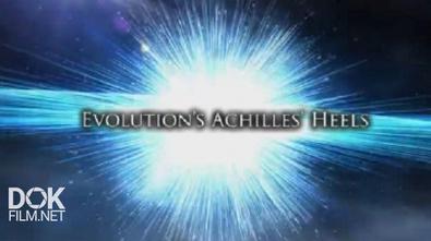 Ахиллесовы Пяты Эволюции / Evolution\'S Achilles\' Heels (2014)